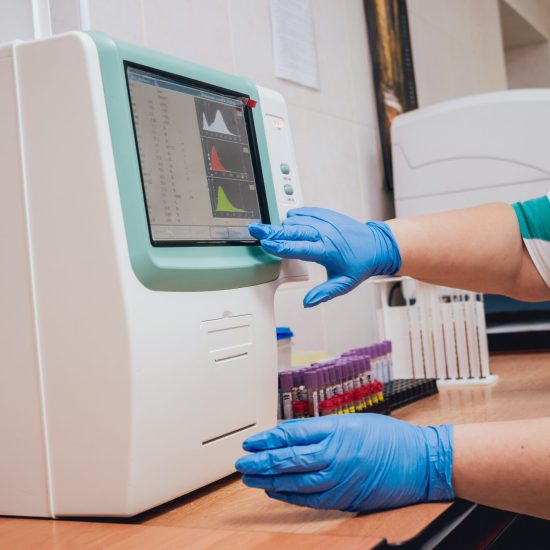 Laboratory assistant conducts a blood test. Medical equipment.